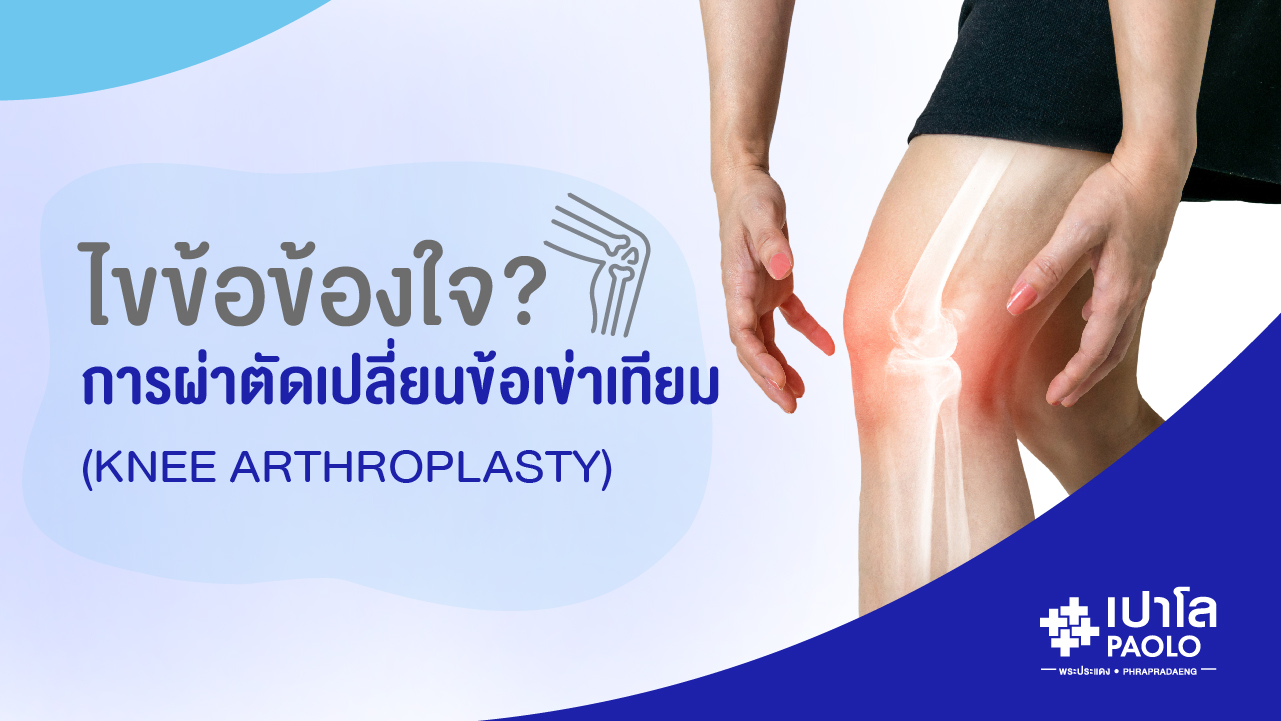 ไขข้อข้องใจ การผ่าตัดเปลี่ยนข้อเข่าเทียม (Knee Arthroplasty)